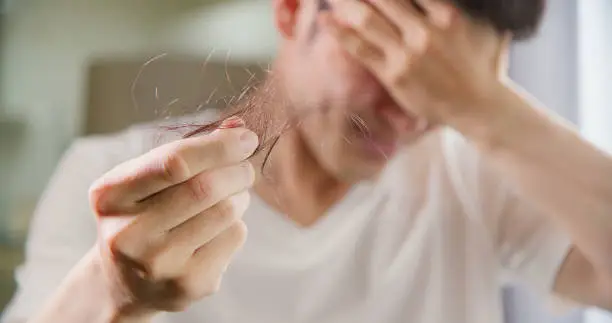 A worried man holding a bunch of fallen hair in his hand, indicating hair loss or thinning